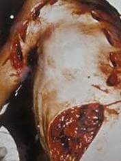 This Is What Shark Can Do To You