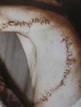 This Is What Shark Can Do To You