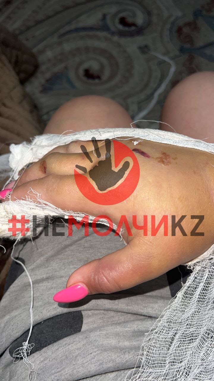 Ex-Husband Attacks Wife And Her Boyfriend With Bat In Kazakhstan