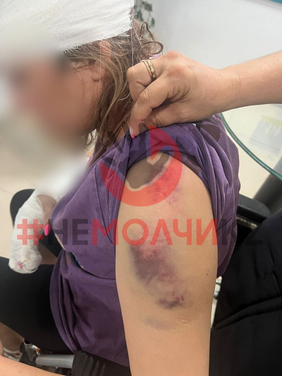 Ex-Husband Attacks Wife And Her Boyfriend With Bat In Kazakhstan