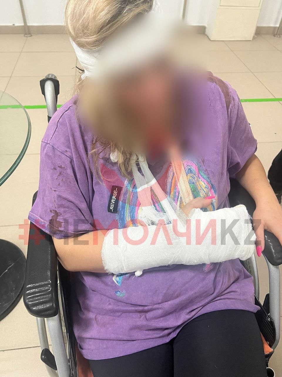 Ex-Husband Attacks Wife And Her Boyfriend With Bat In Kazakhstan