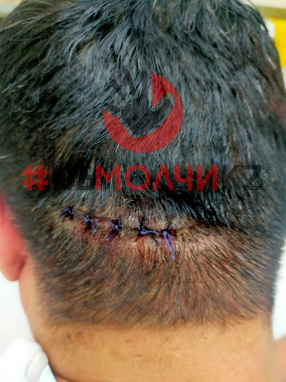 Ex-Husband Attacks Wife And Her Boyfriend With Bat In Kazakhstan