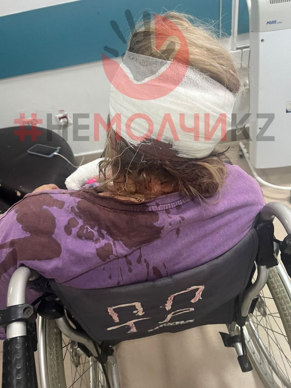 Ex-Husband Attacks Wife And Her Boyfriend With Bat In Kazakhstan