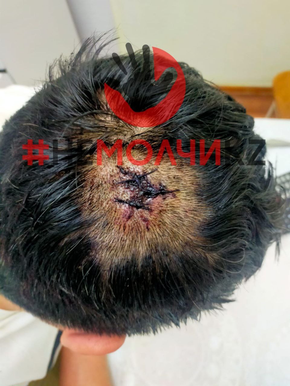 Ex-Husband Attacks Wife And Her Boyfriend With Bat In Kazakhstan