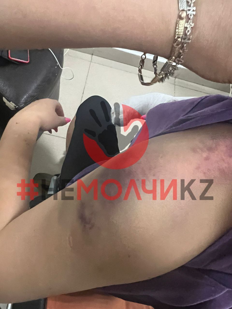 Ex-Husband Attacks Wife And Her Boyfriend With Bat In Kazakhstan