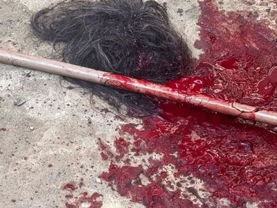 Woman's Scalp Ripped Off By Her Own Pitbull (Photos)