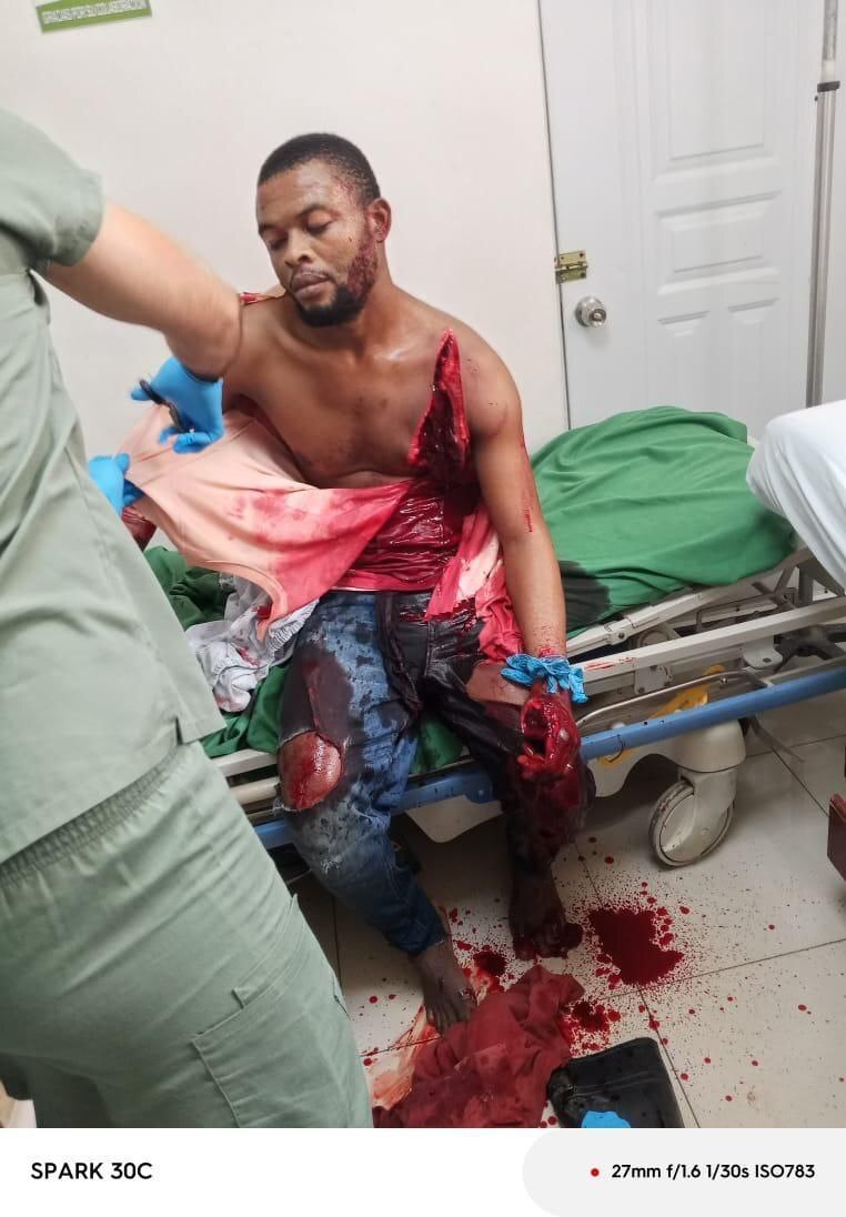 Man Brutally Slashed By Machete (Photos)