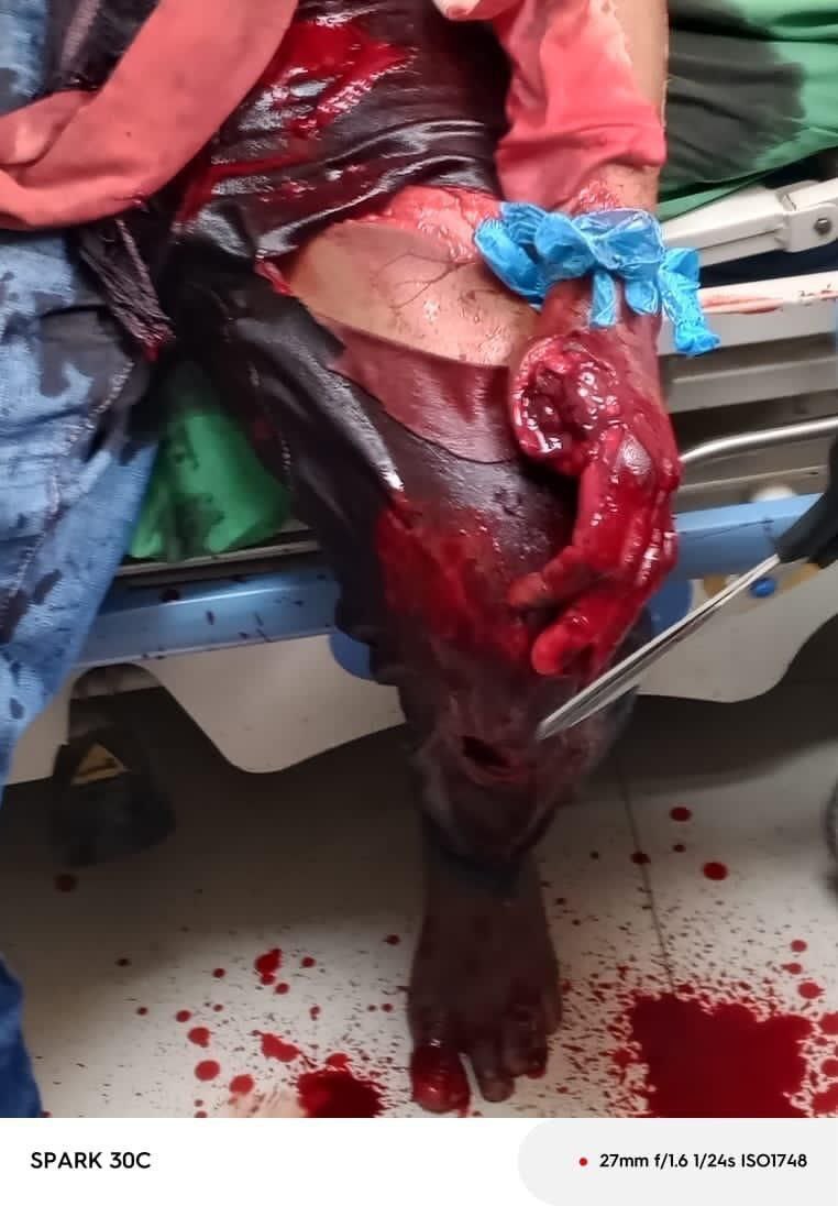 Man Brutally Slashed By Machete (Photos)