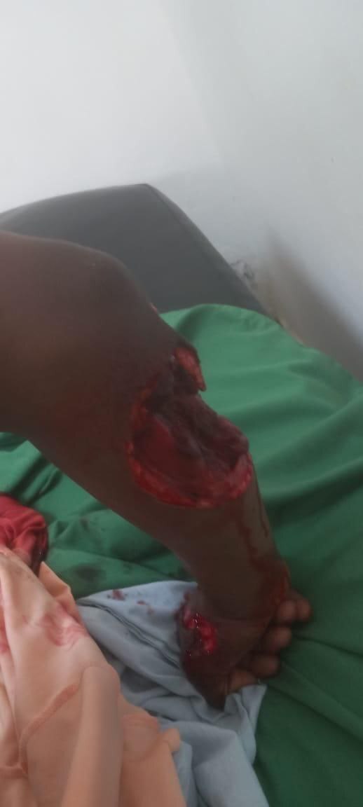 Man Brutally Slashed By Machete (Photos)