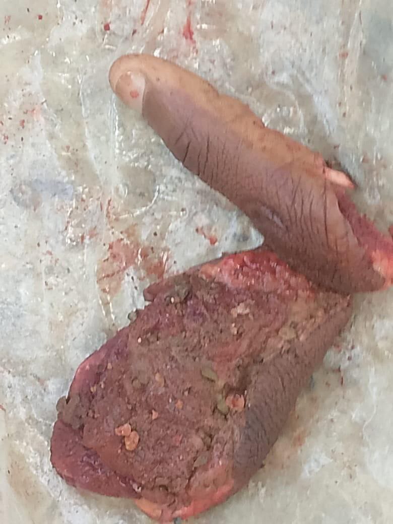 Man Brutally Slashed By Machete (Photos)