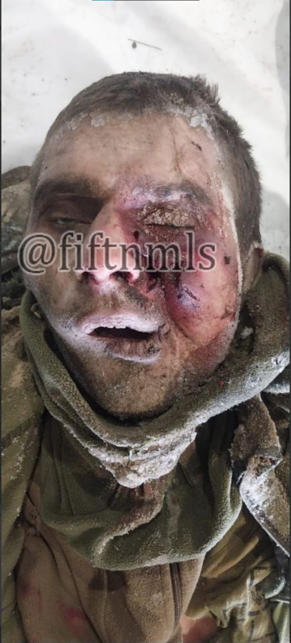 Ukrainian platoon killed by frostbite.