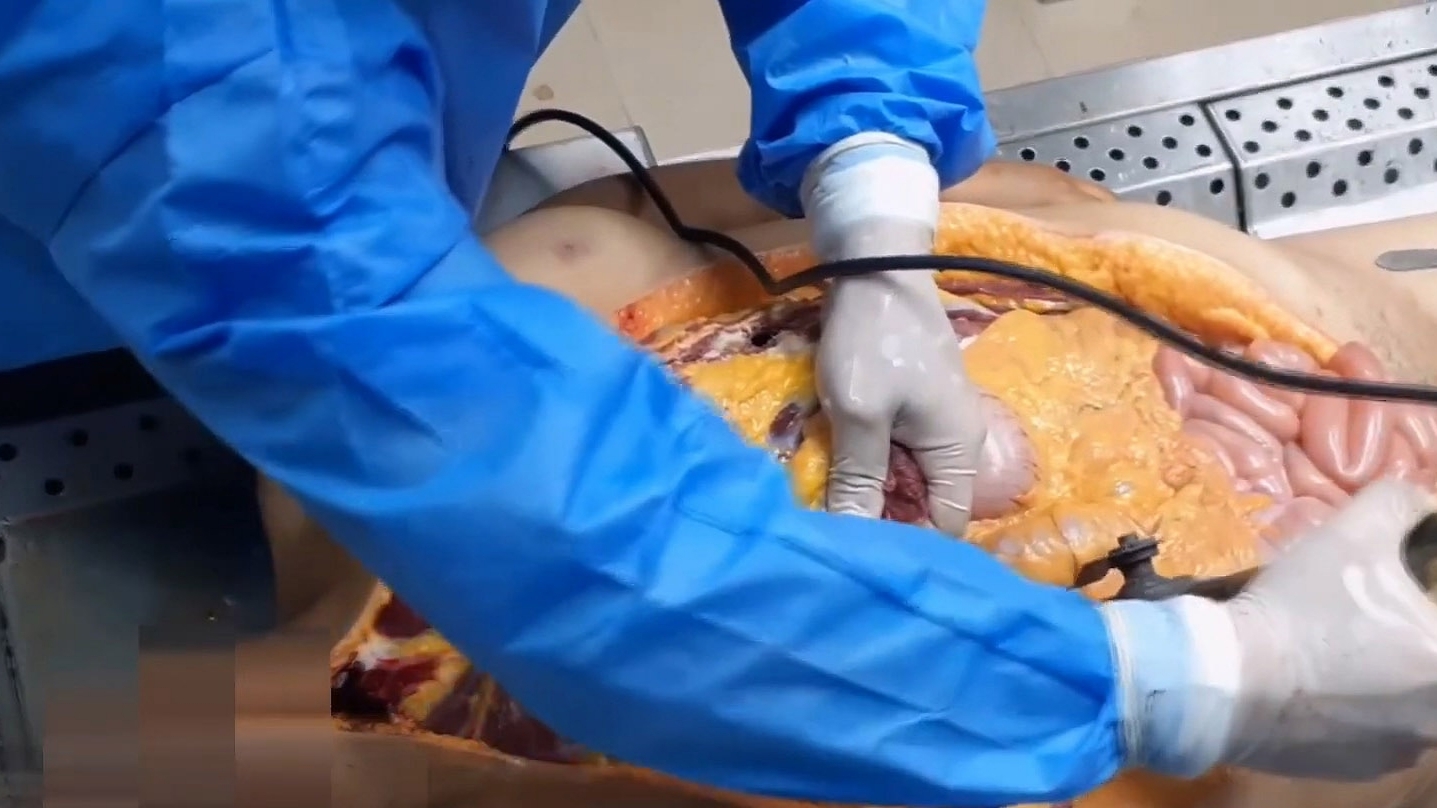 Autopsy of drowned woman