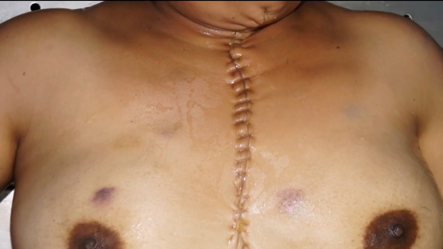 Autopsy of drowned woman