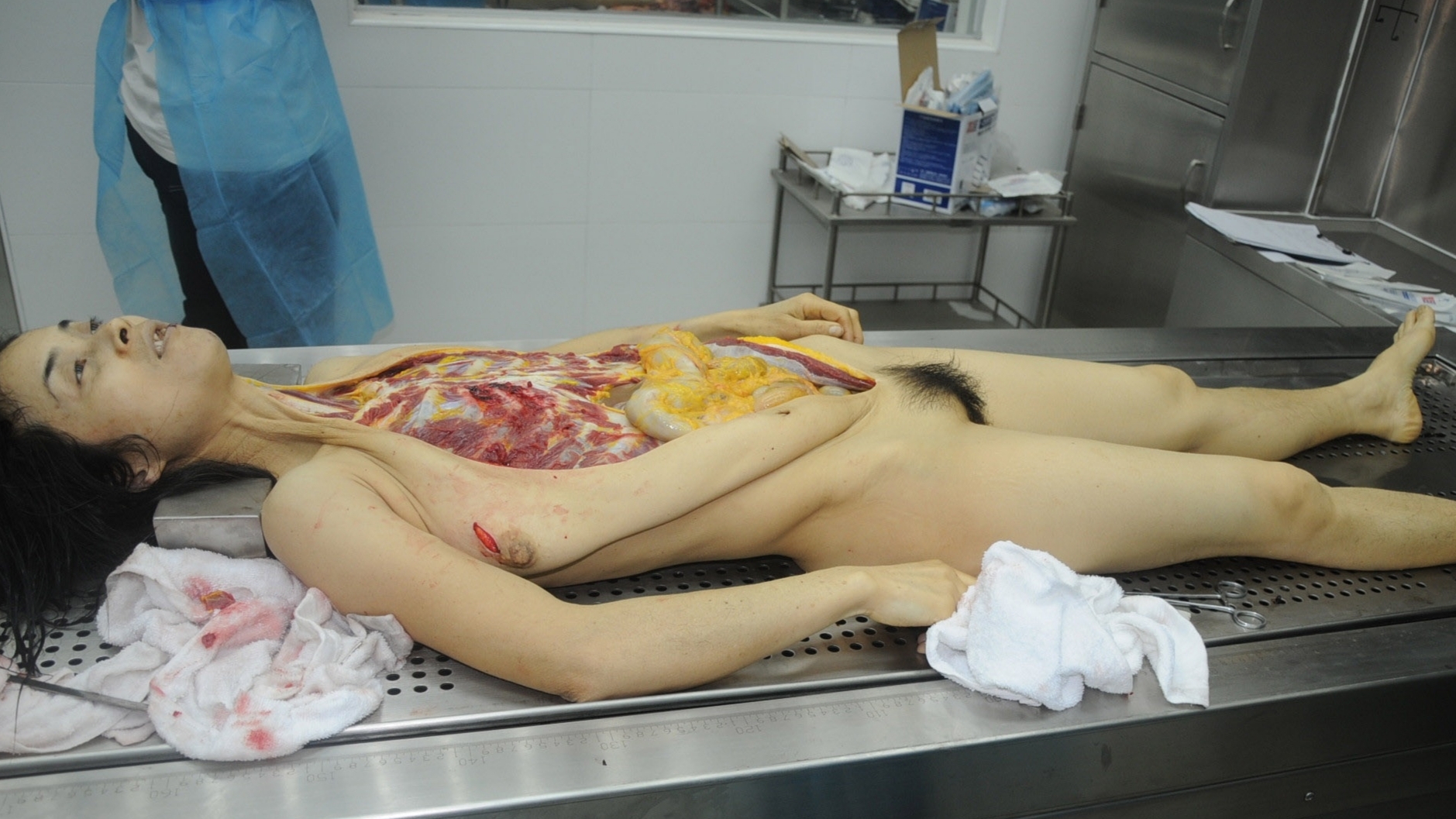 Detailed dissection of stabbed Chinese woman