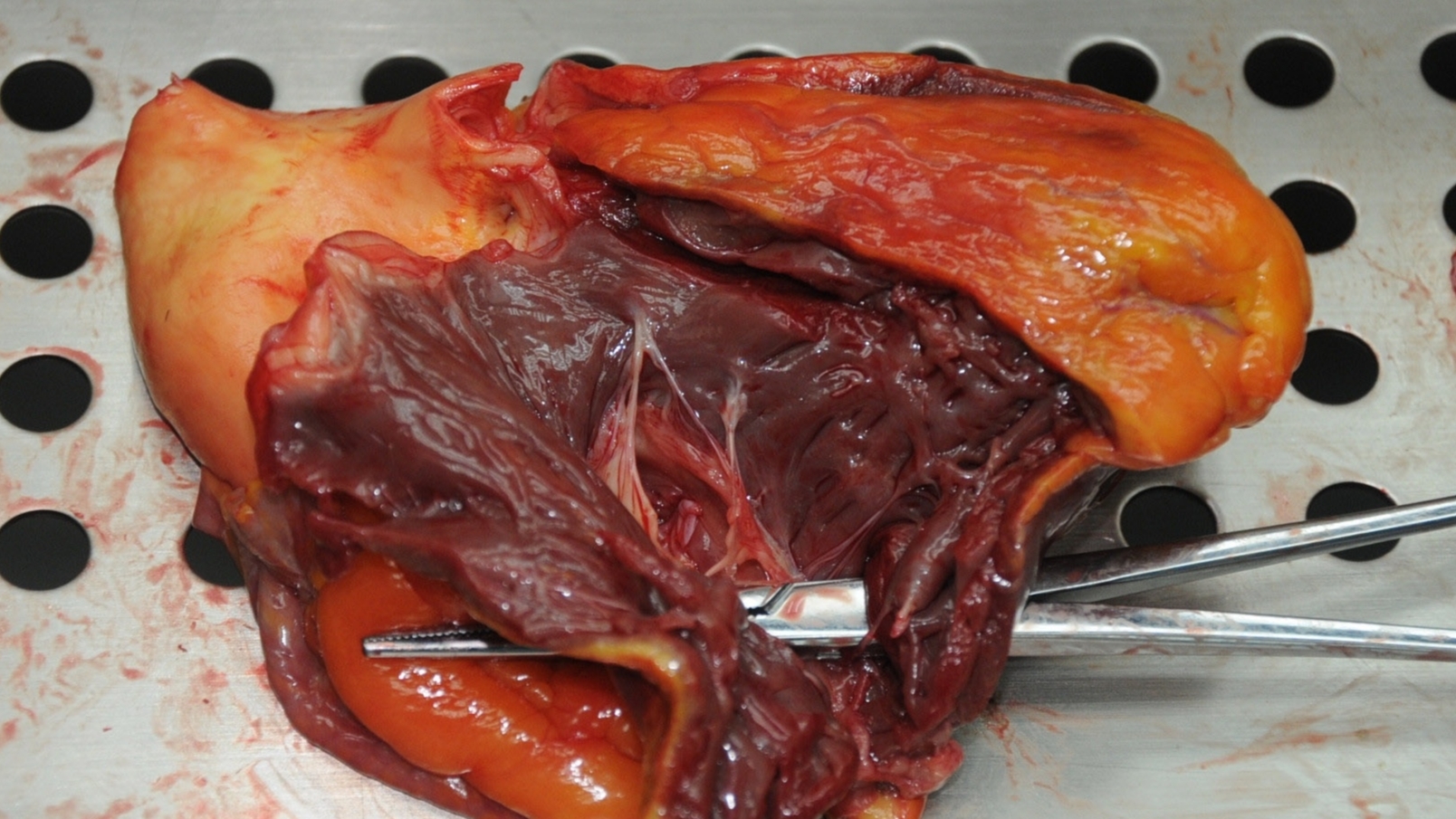 Detailed dissection of stabbed Chinese woman