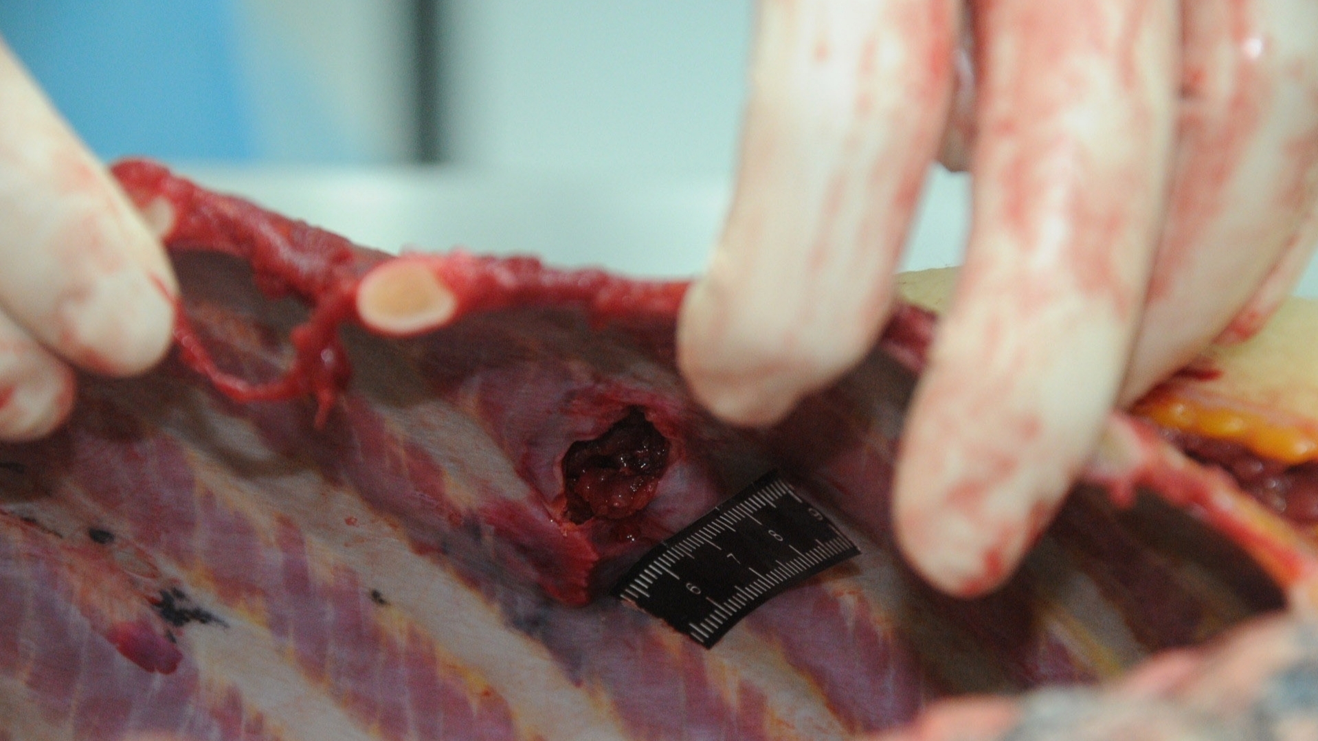 Detailed dissection of stabbed Chinese woman