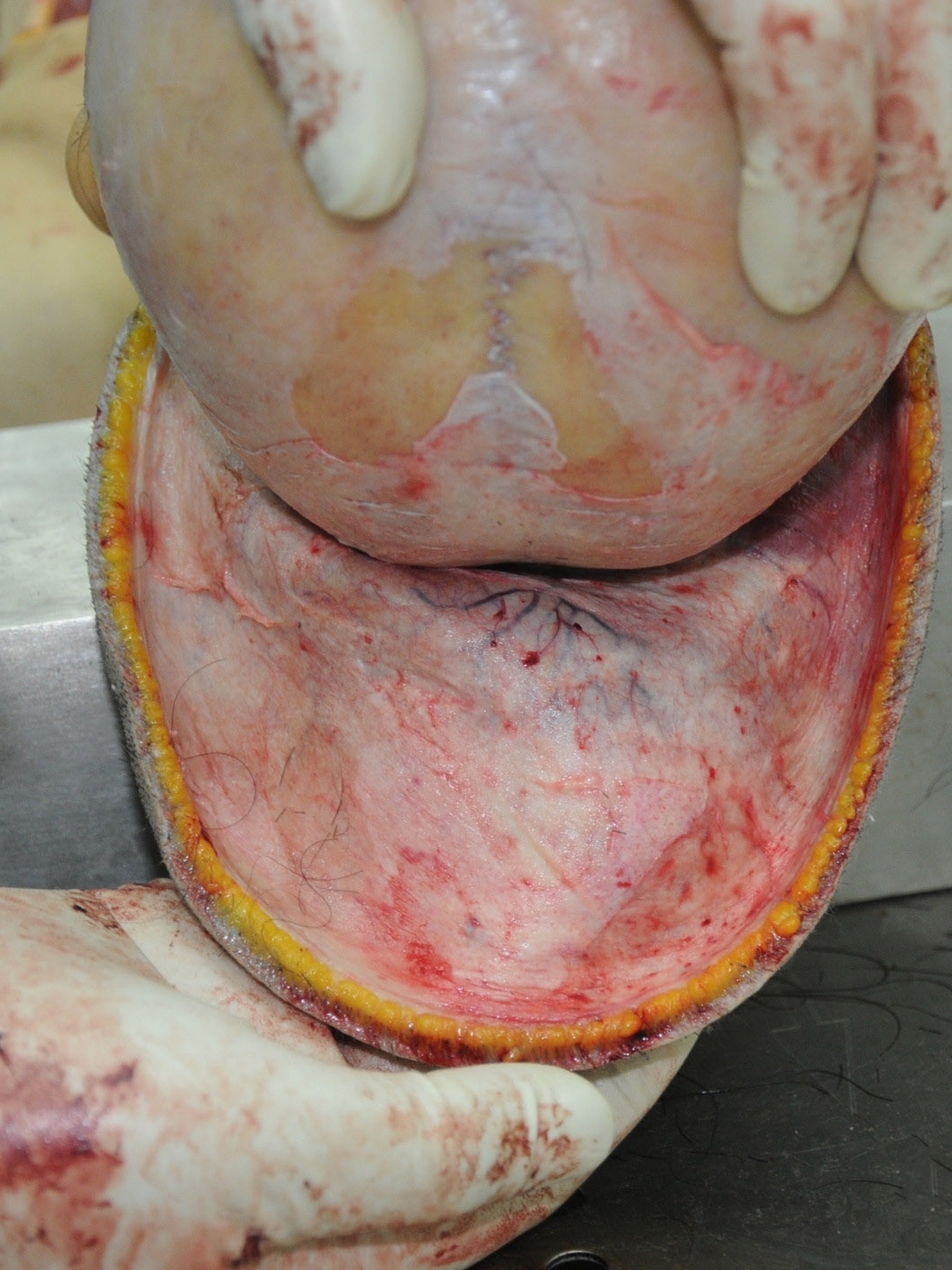 Detailed dissection of stabbed Chinese woman