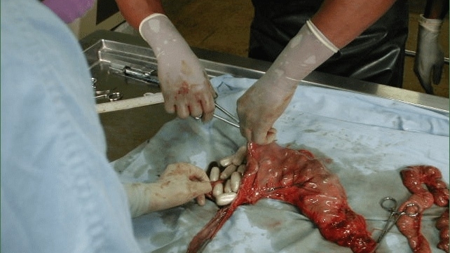 Autopsy of a drug mule