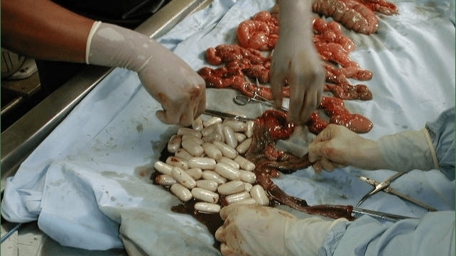 Autopsy of a drug mule