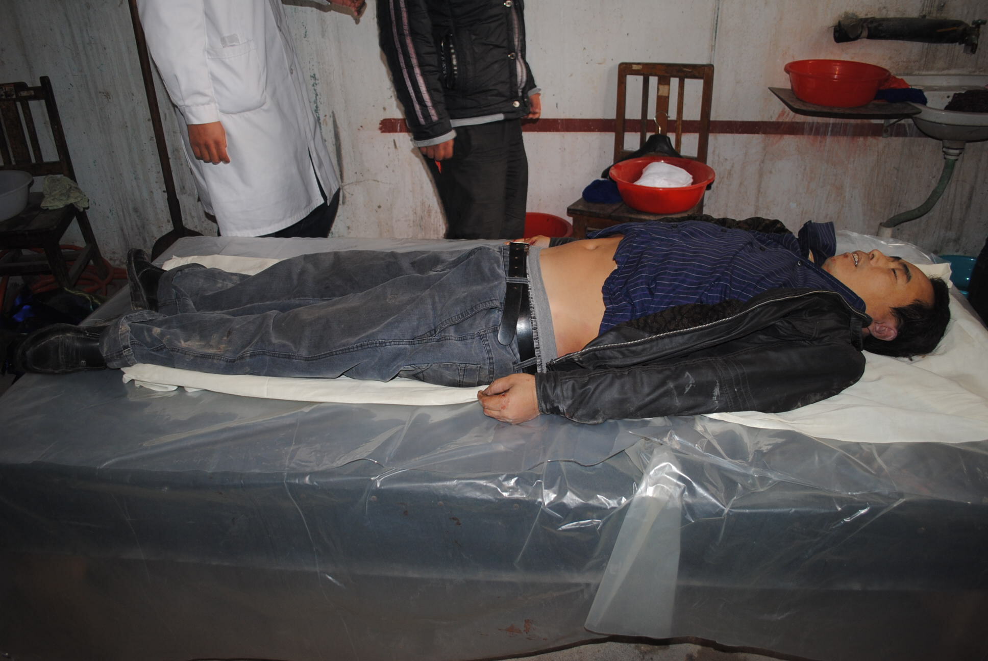 the autopsy of Chinese man