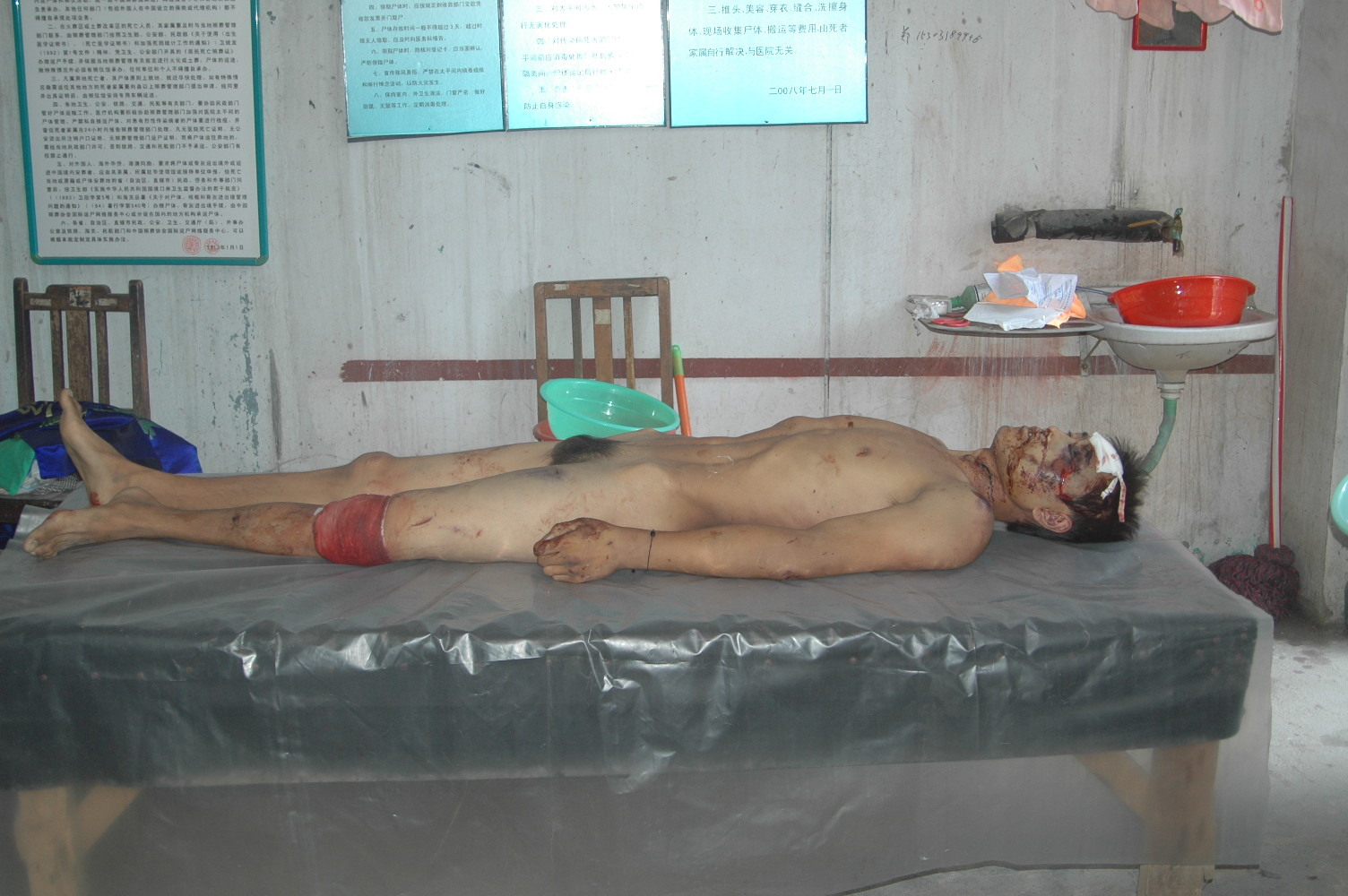 the autopsy of Chinese man