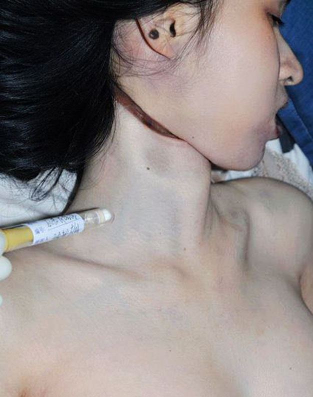 MILF Hanged Herself After Her Younger Lover Left Her