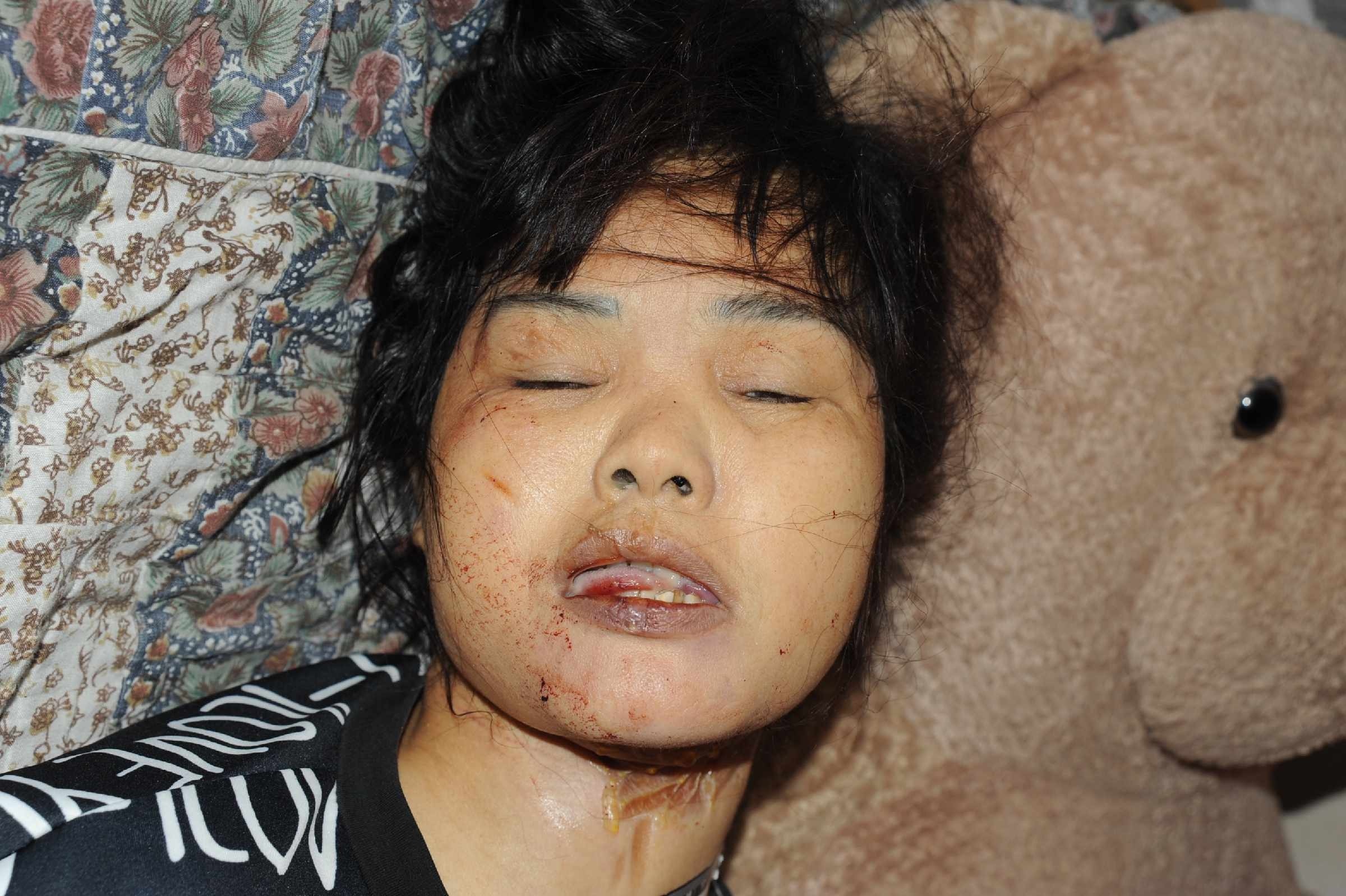 Chinese Women in Morgue