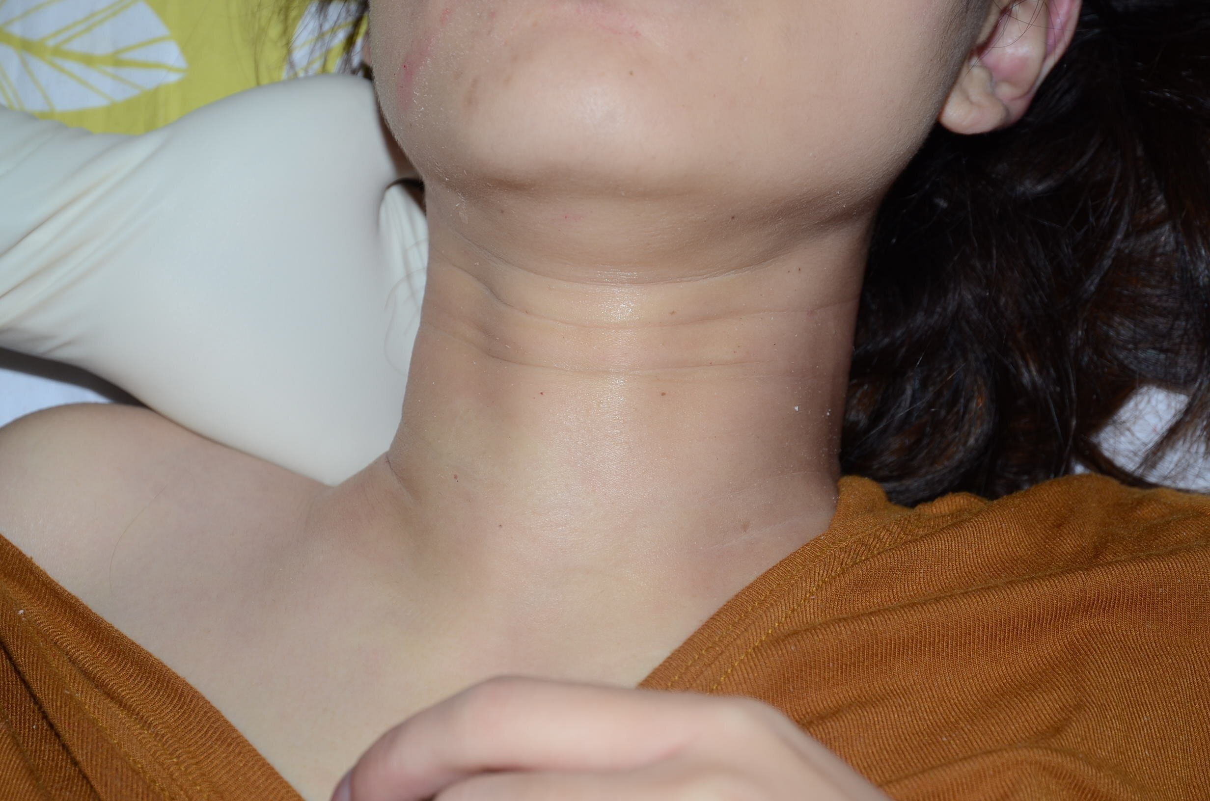 Beautiful Chinese Woman's Poison Suicide