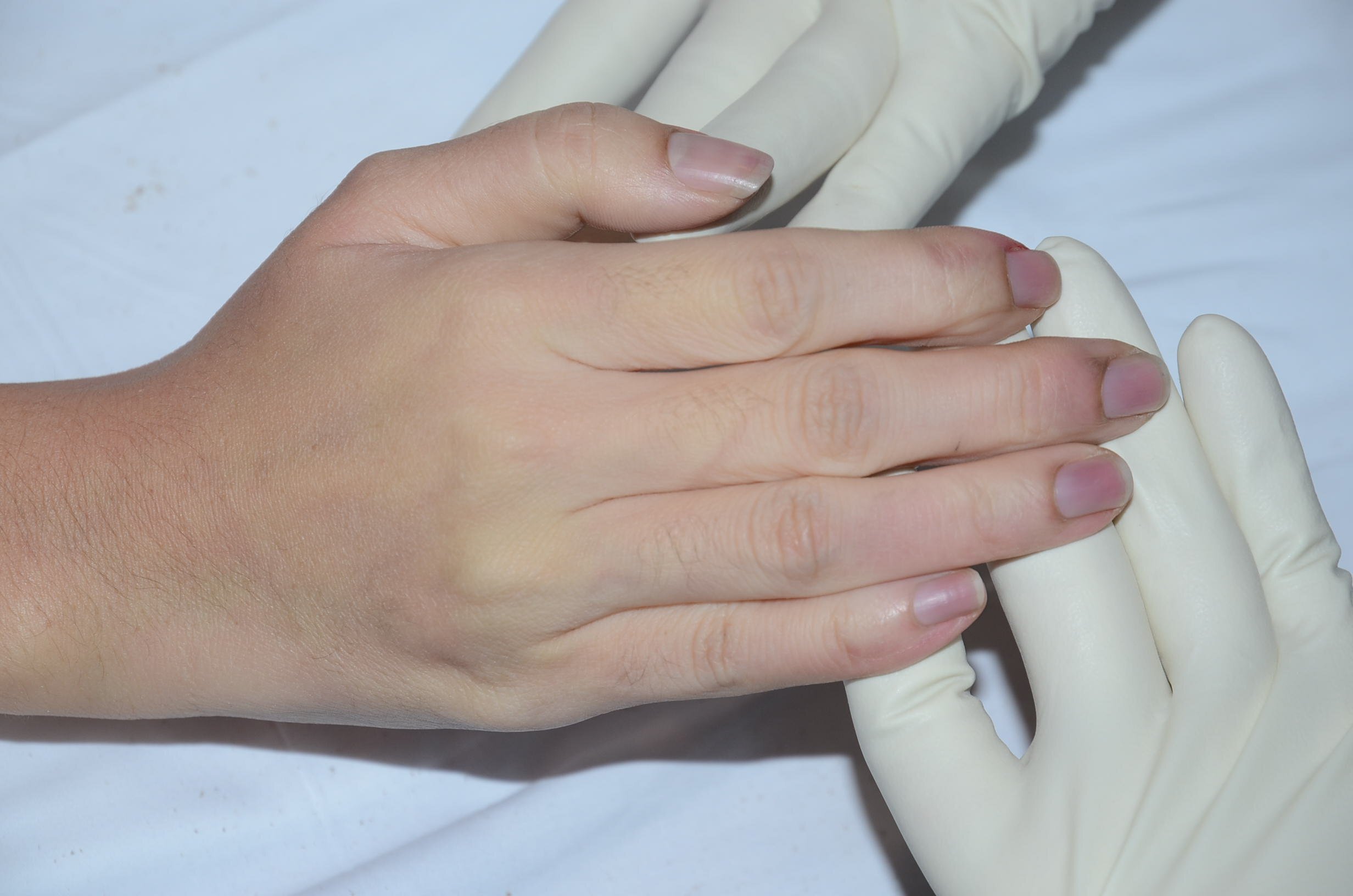 Beautiful Chinese Woman's Poison Suicide