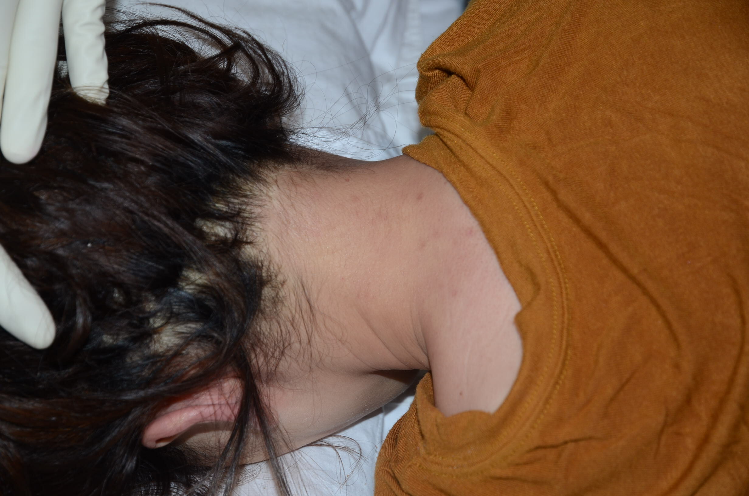 Beautiful Chinese Woman's Poison Suicide