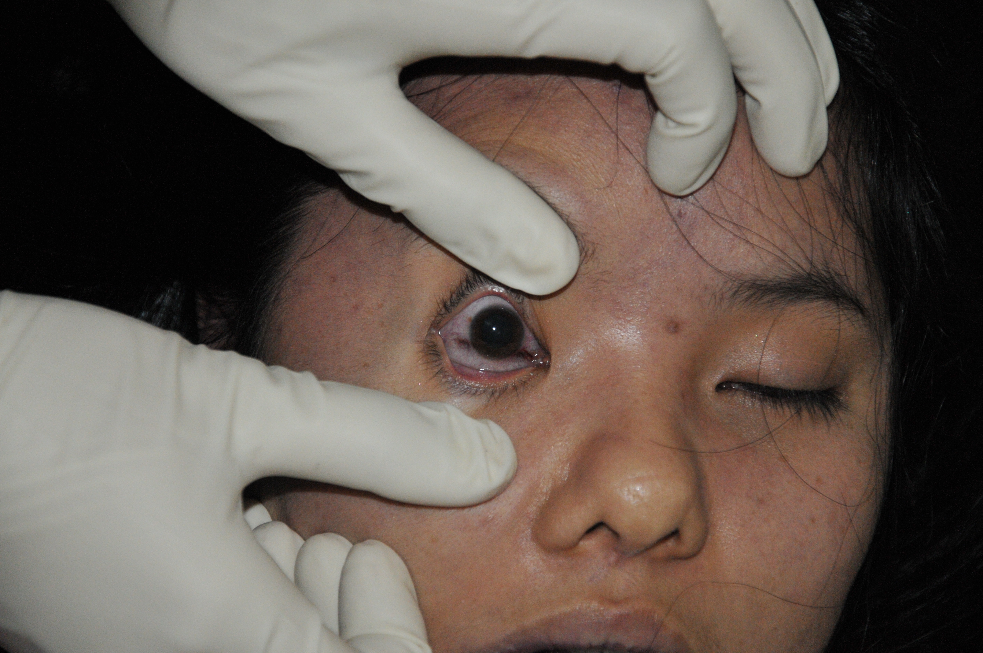 Pretty Woman's Suicide... Sad