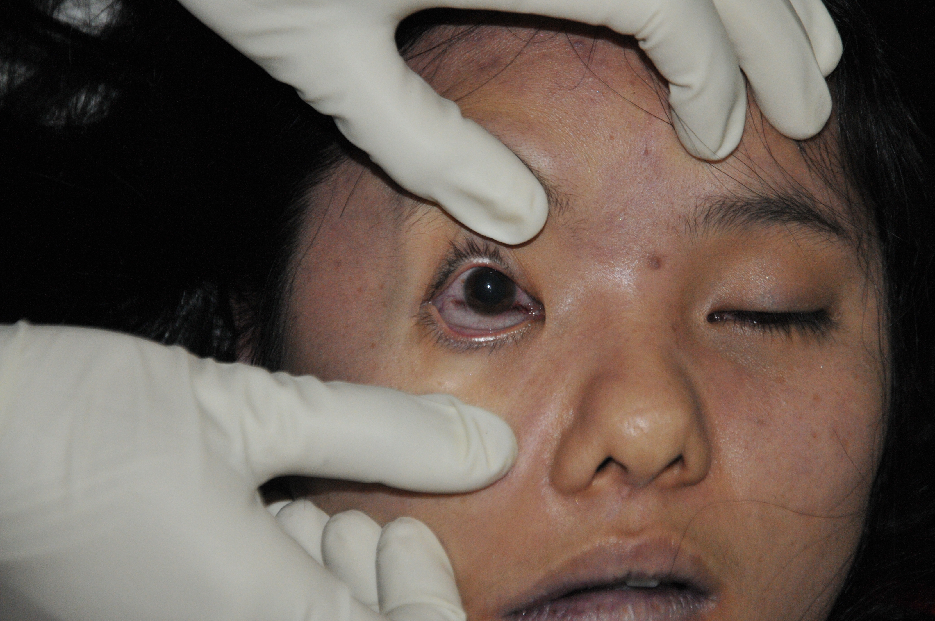 Pretty Woman's Suicide... Sad