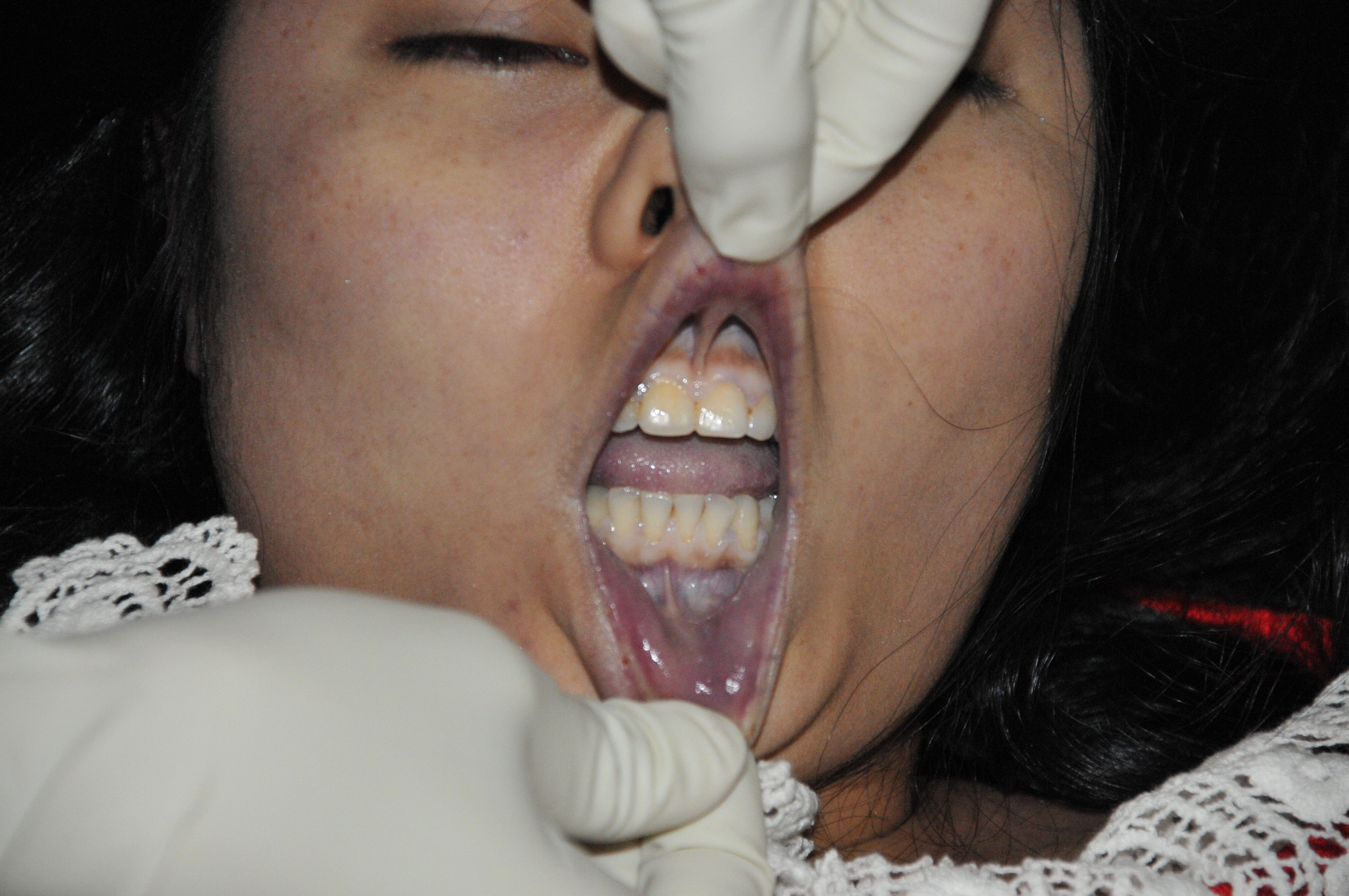 Pretty Woman's Suicide... Sad