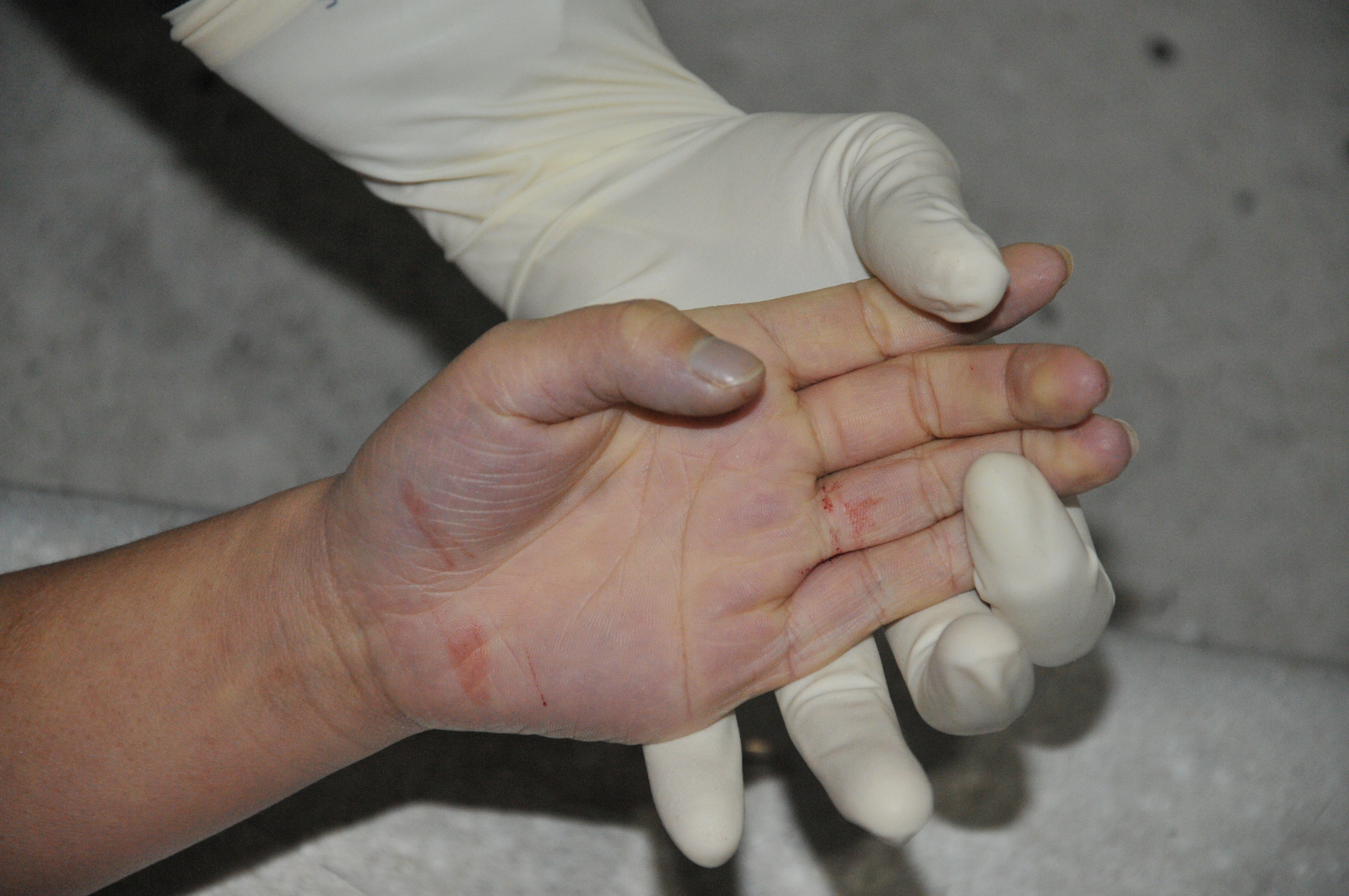 Pretty Woman's Suicide... Sad