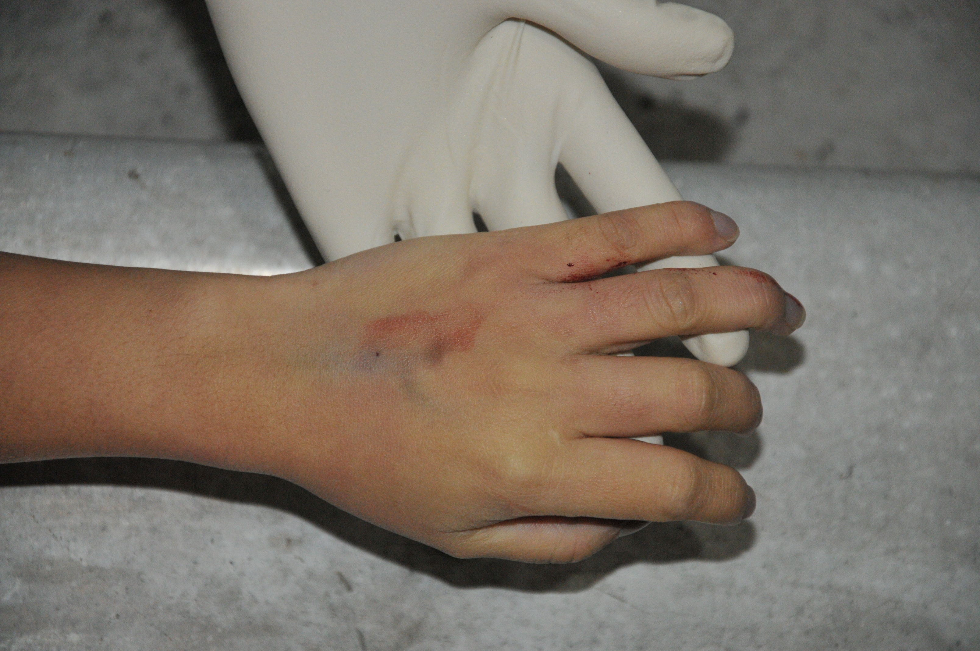 Pretty Woman's Suicide... Sad