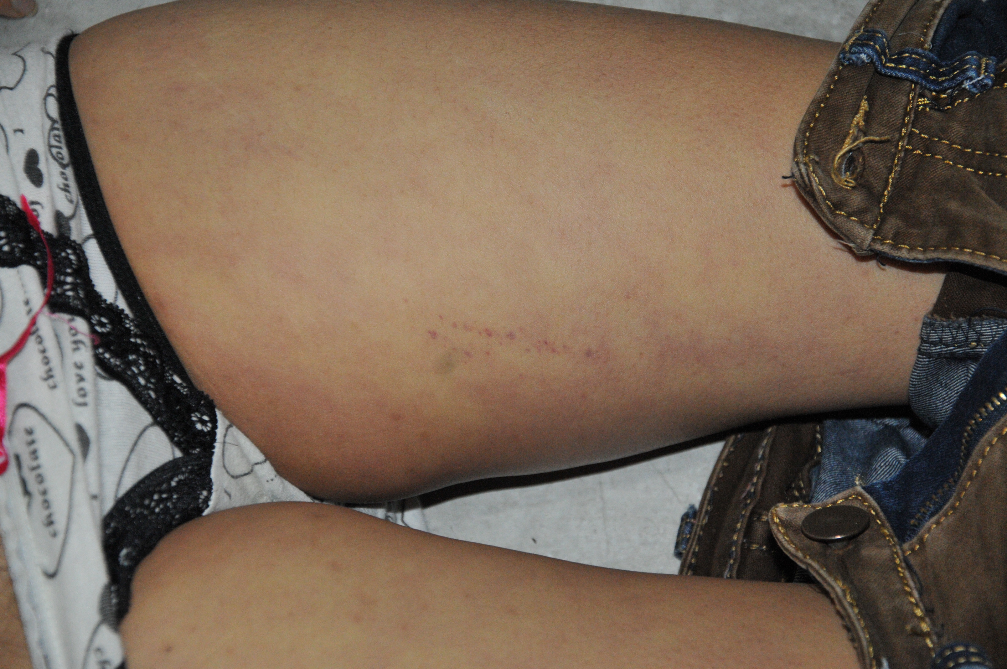 Pretty Woman's Suicide... Sad