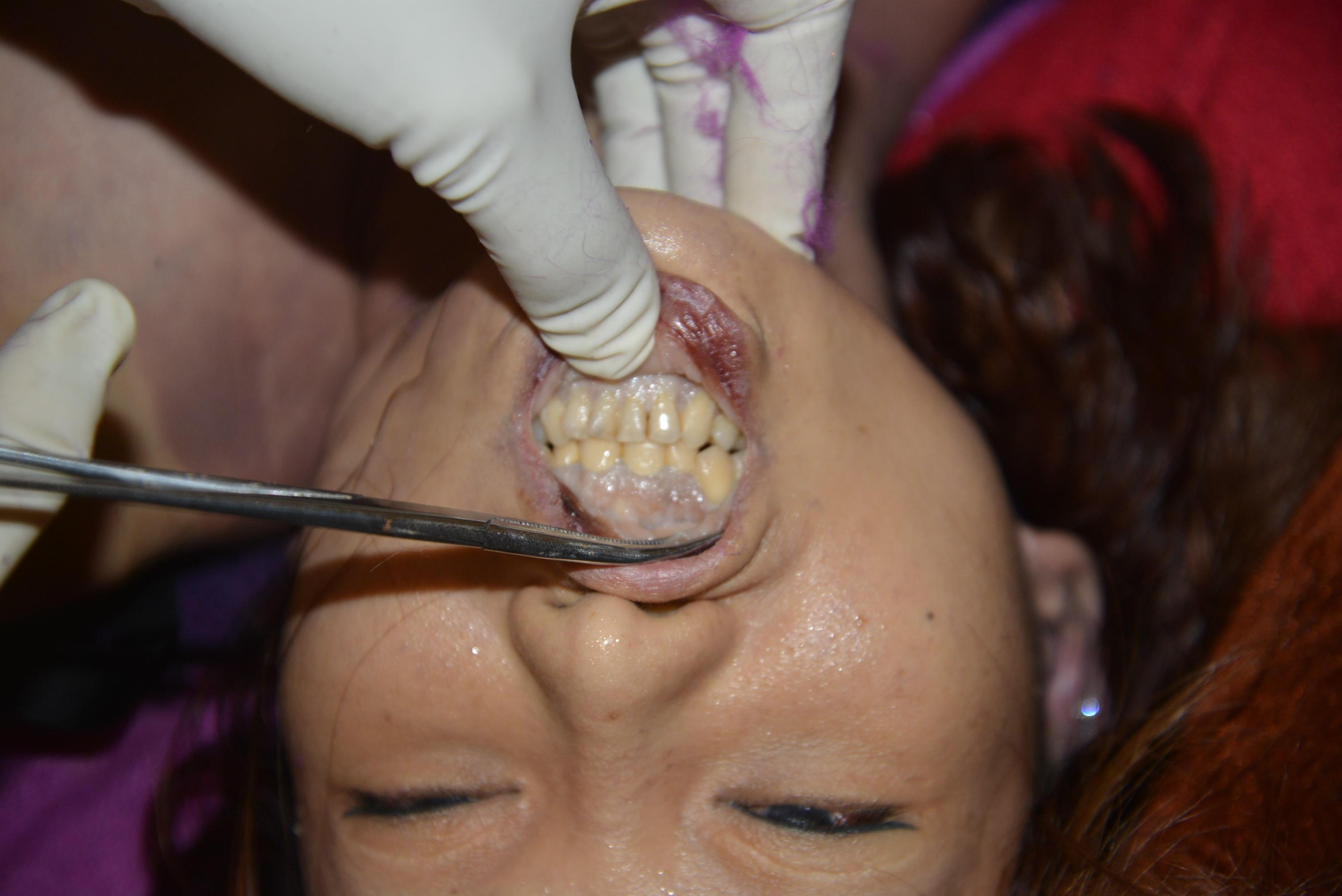 Dead Chinese women prostitute