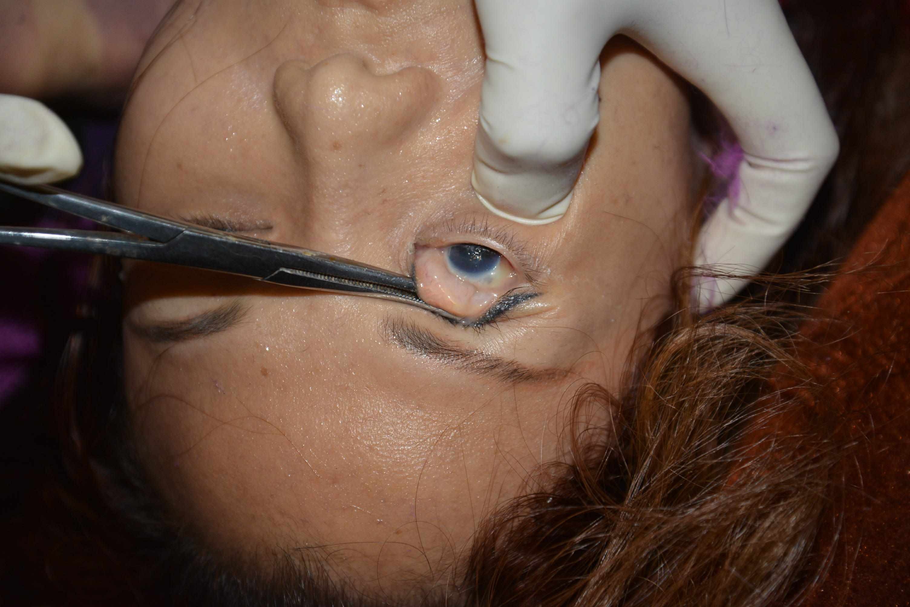 Dead Chinese women prostitute