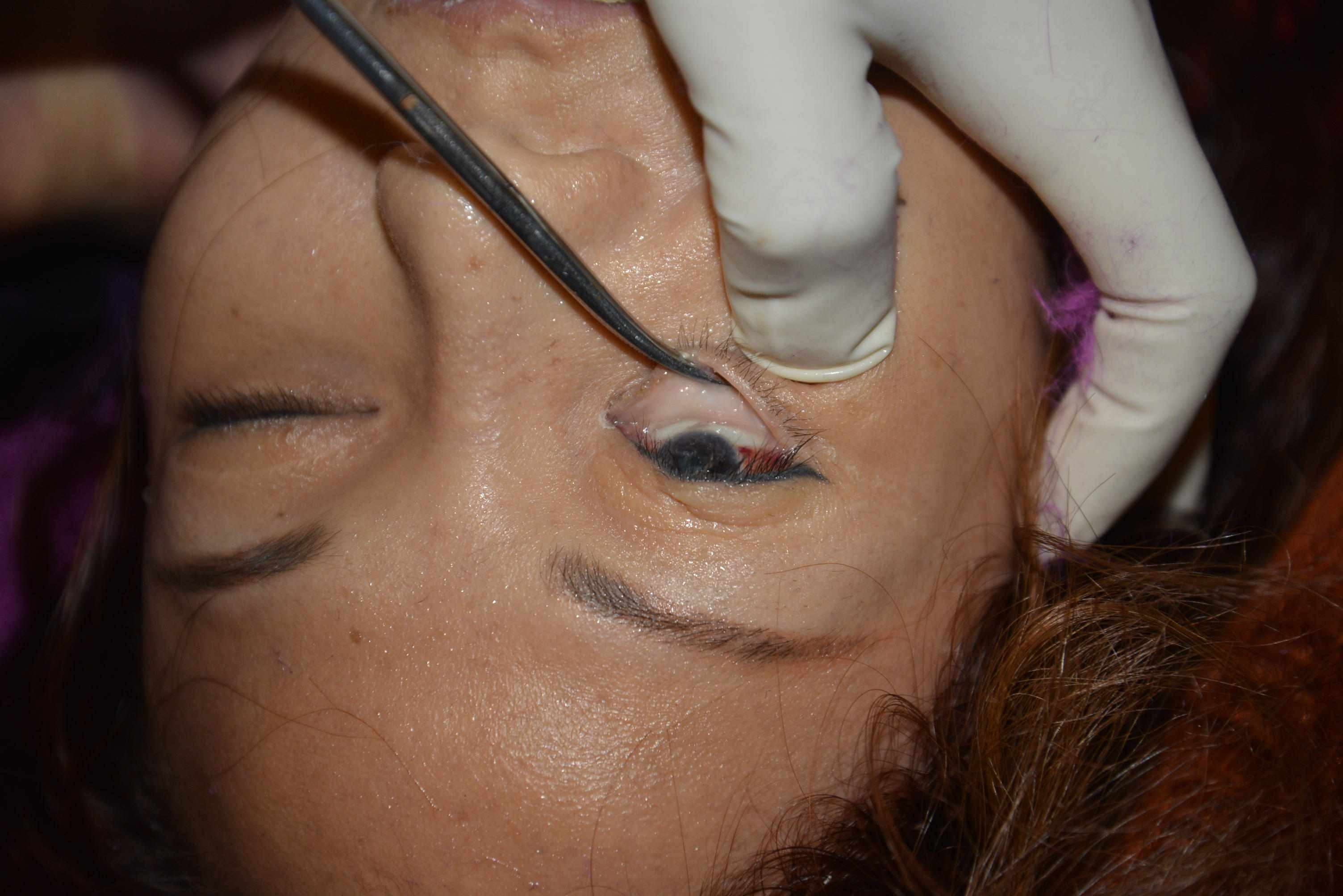 Dead Chinese women prostitute