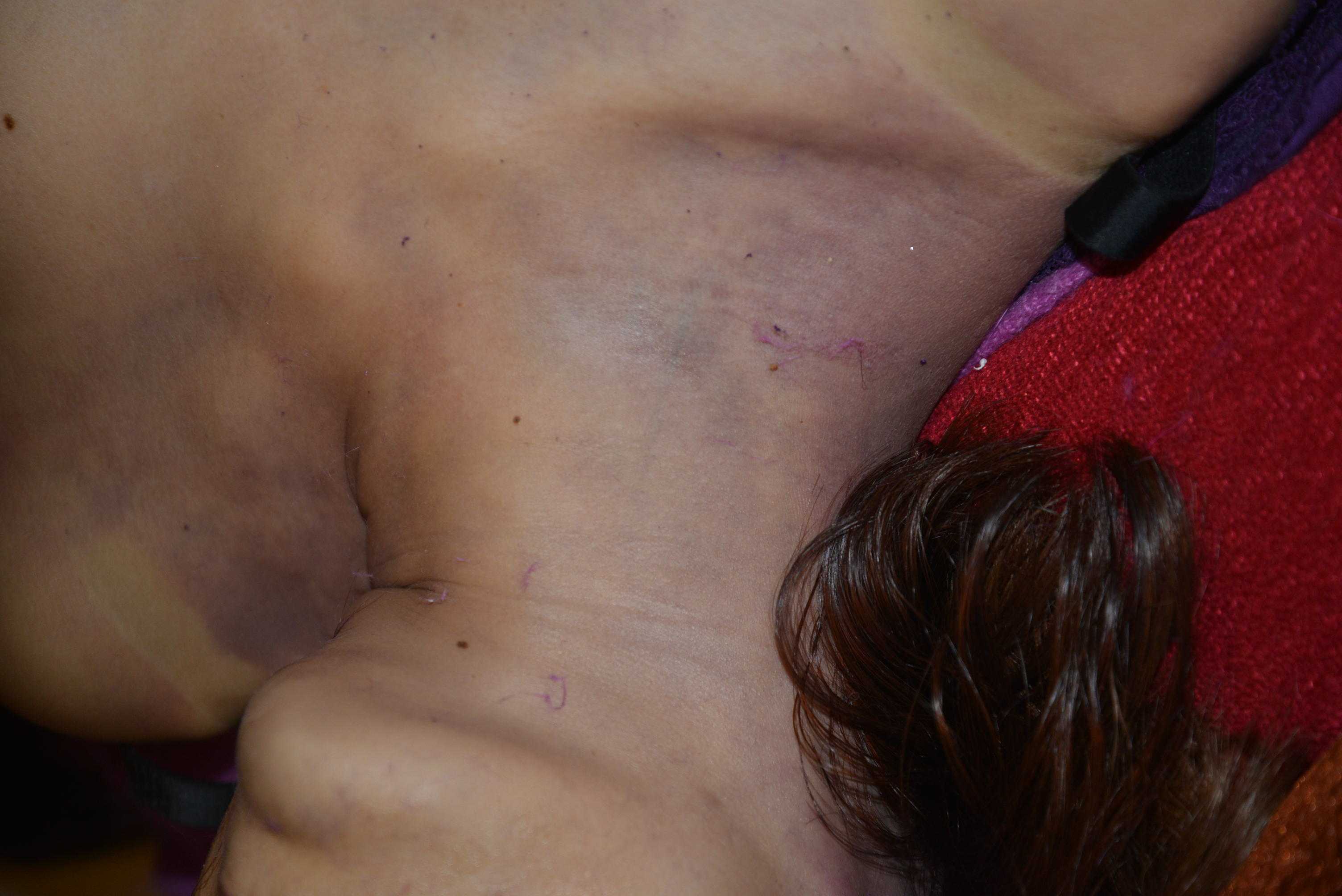 Dead Chinese women prostitute