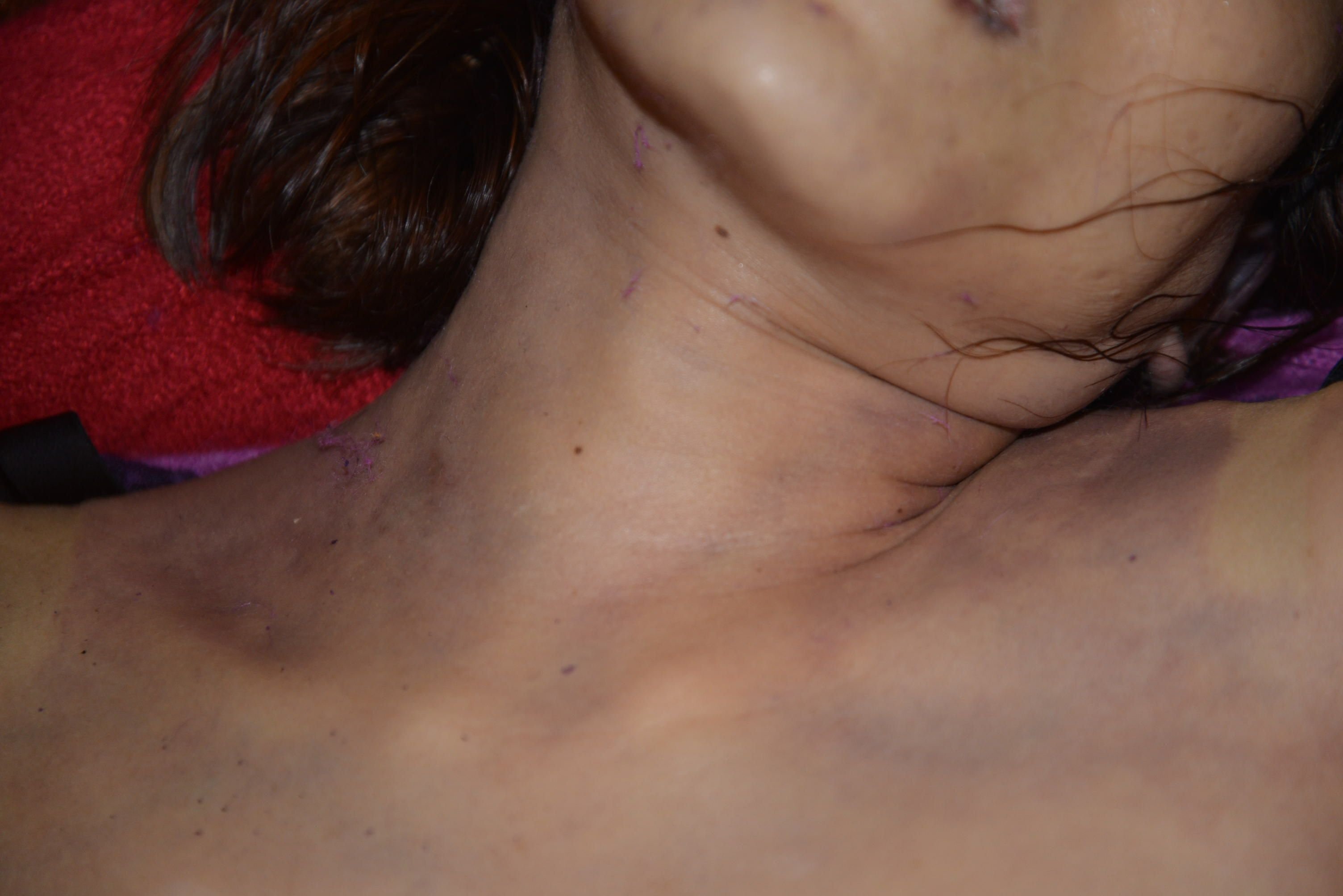 Dead Chinese women prostitute