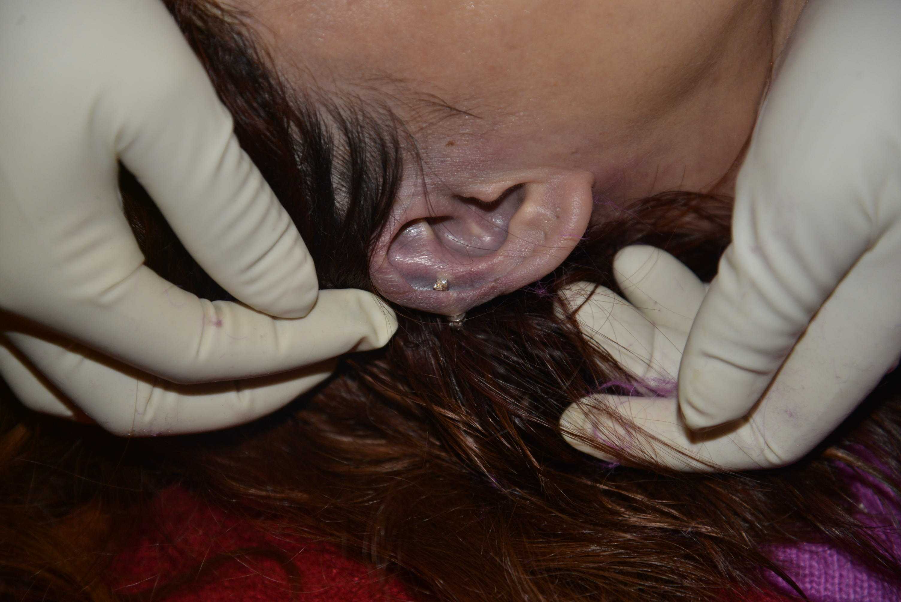 Dead Chinese women prostitute