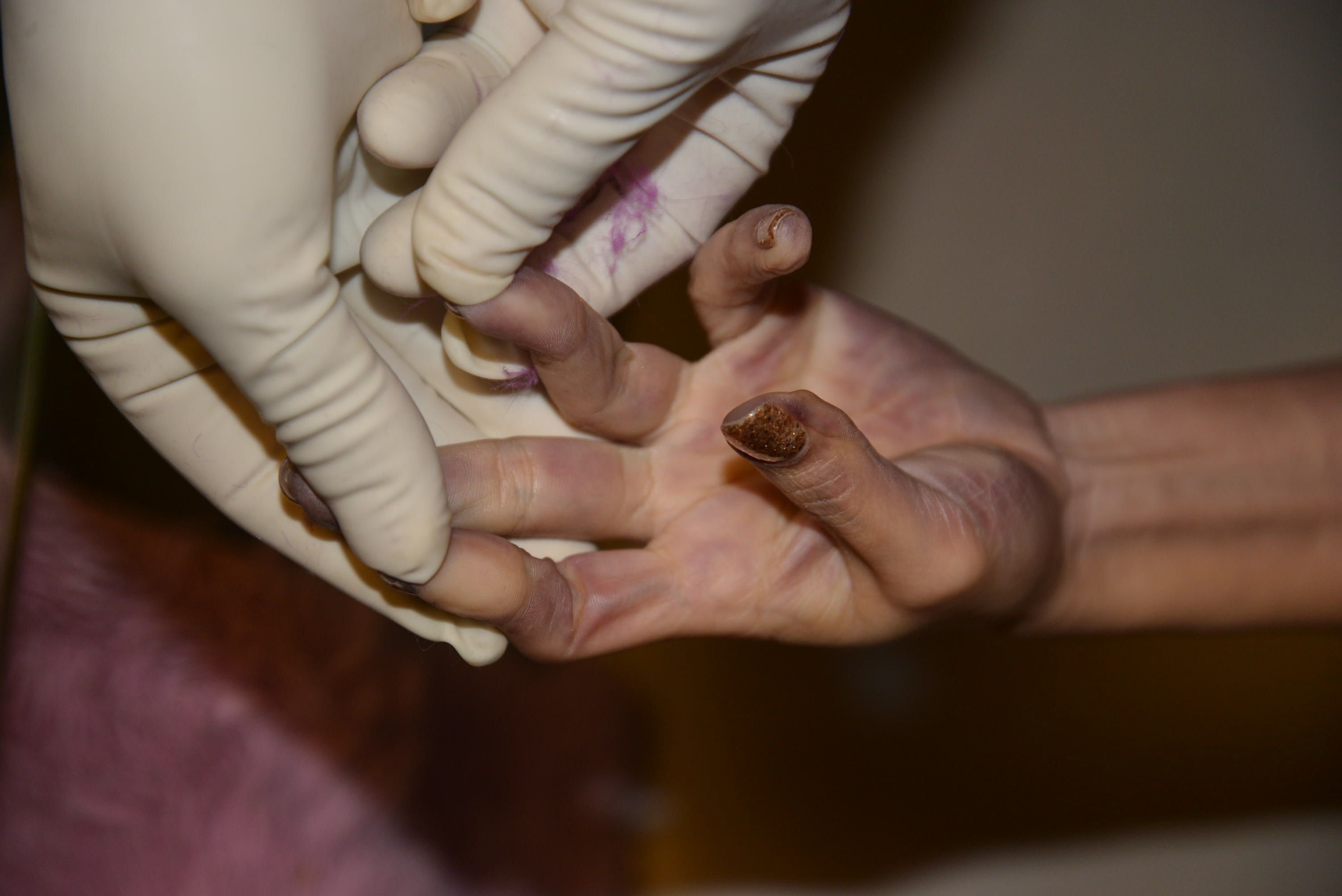 Dead Chinese women prostitute