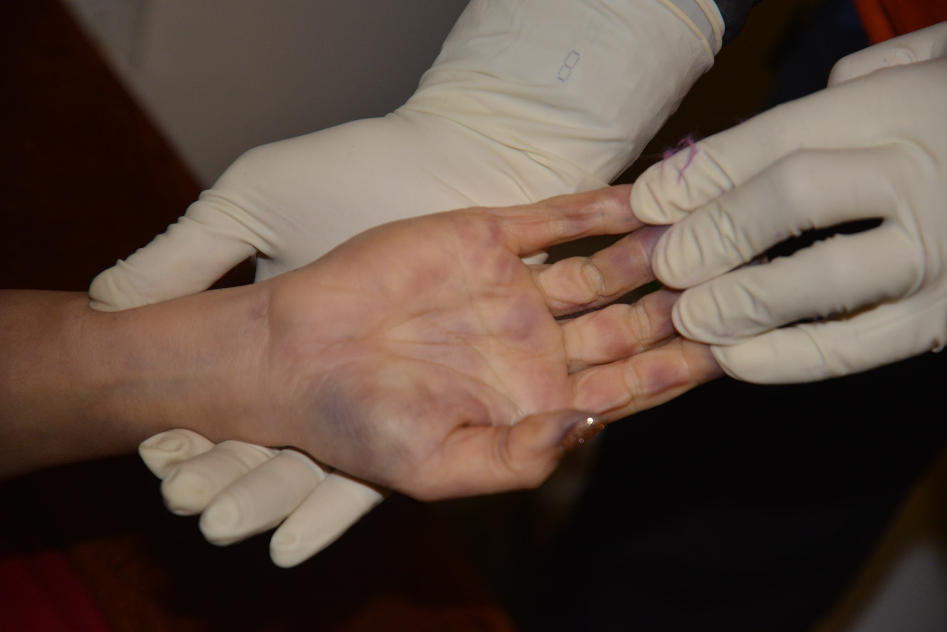 Dead Chinese women prostitute