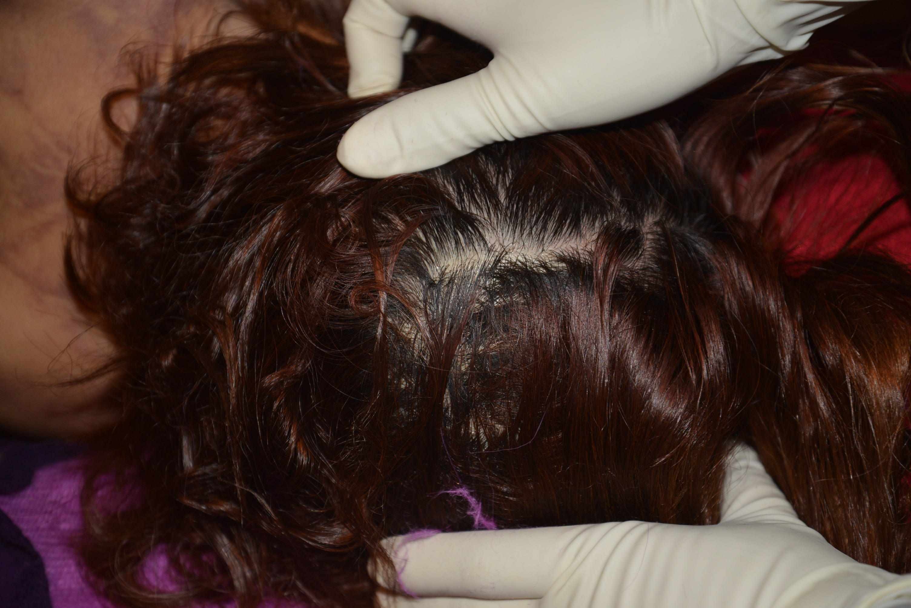 Dead Chinese women prostitute