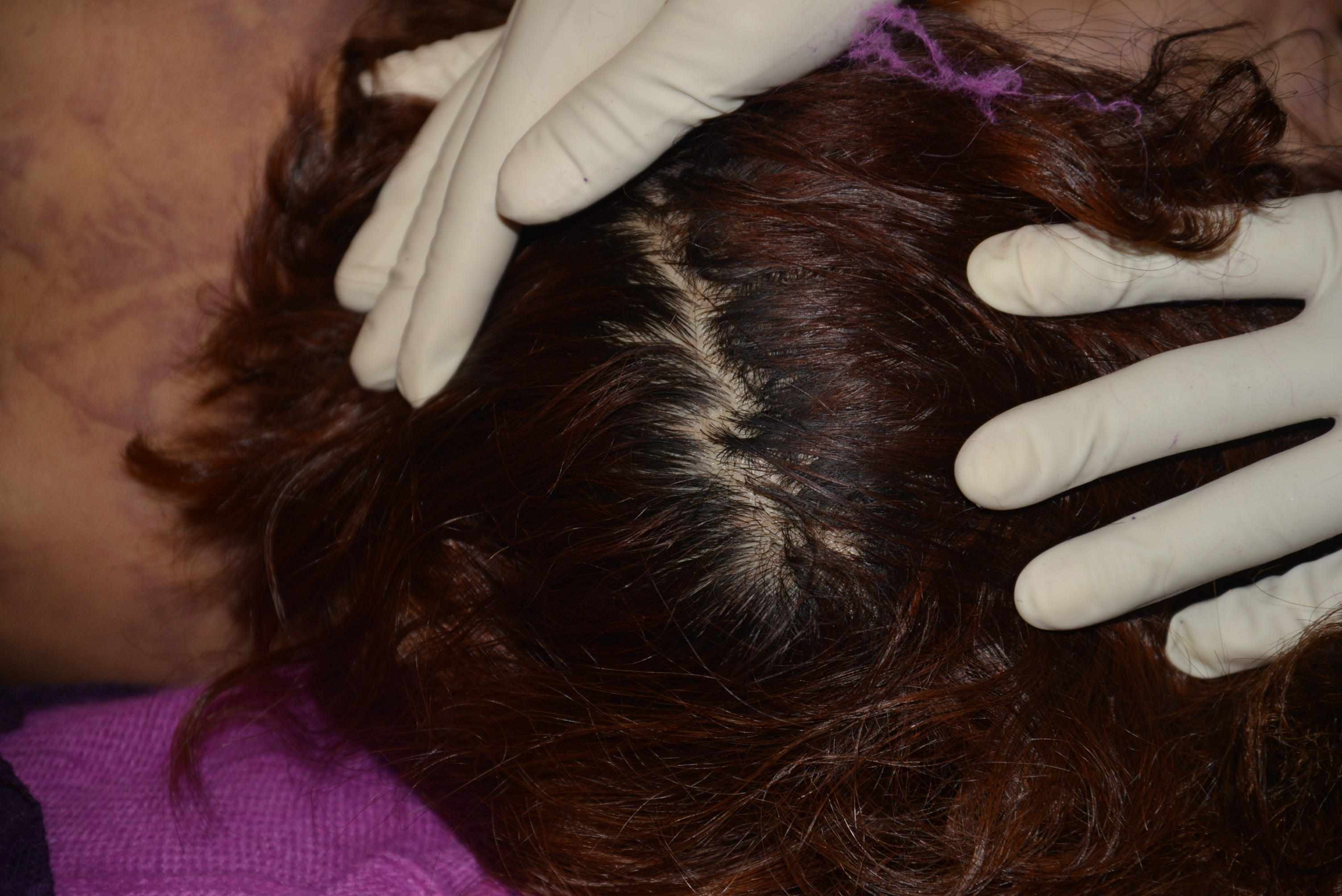 Dead Chinese women prostitute