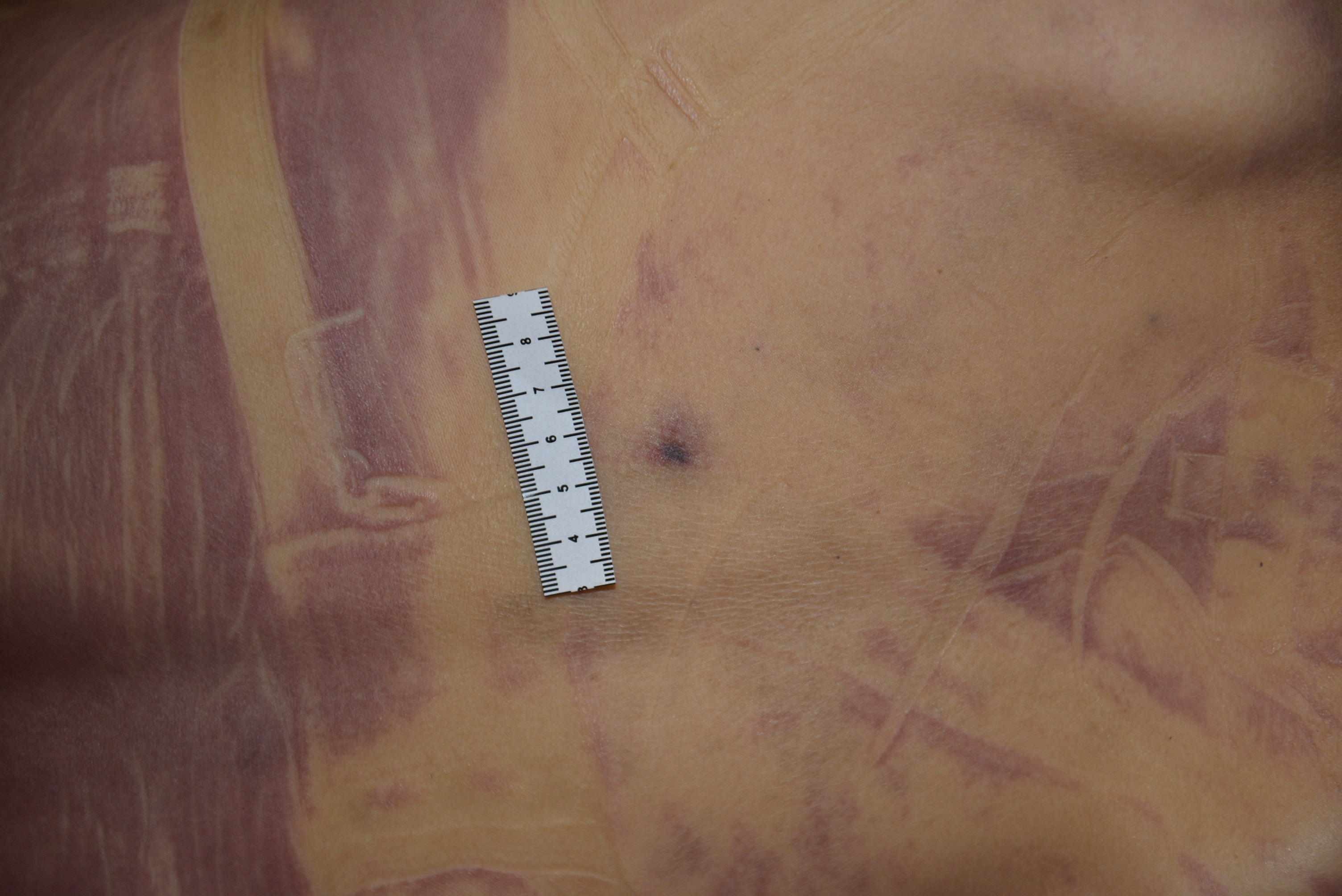 Dead Chinese women prostitute