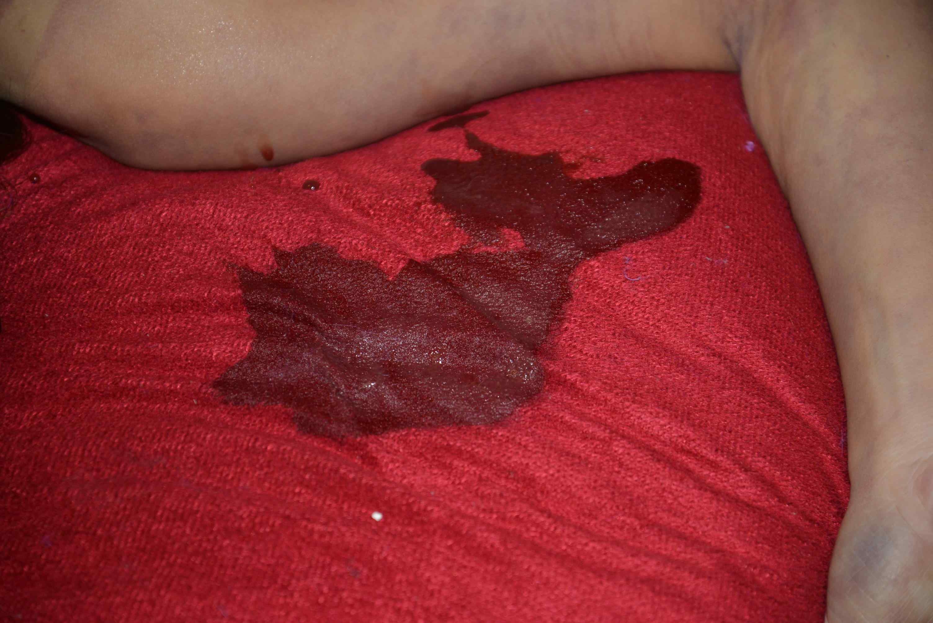 Dead Chinese women prostitute