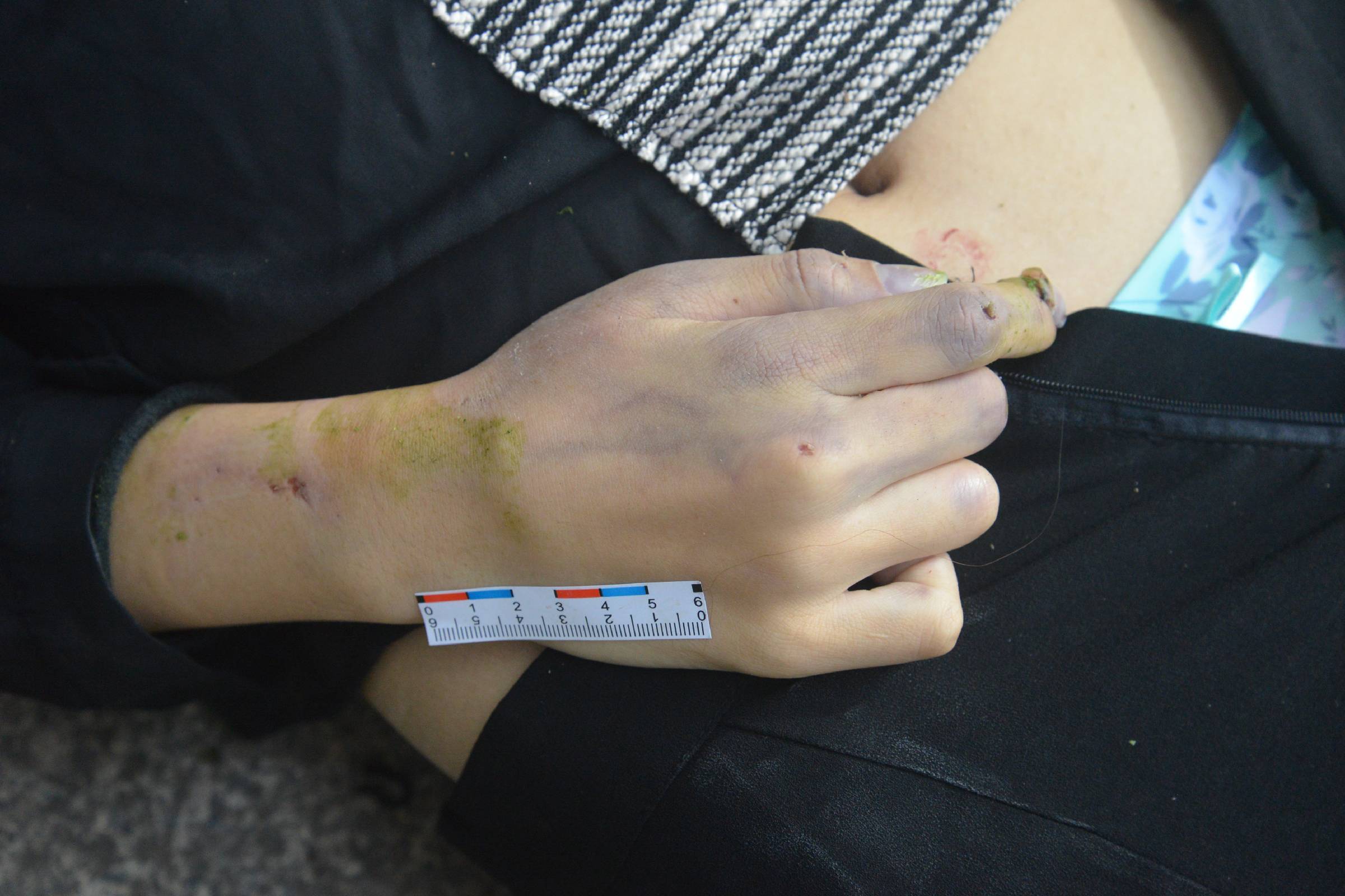 Poor Chinese Woman Murdered.