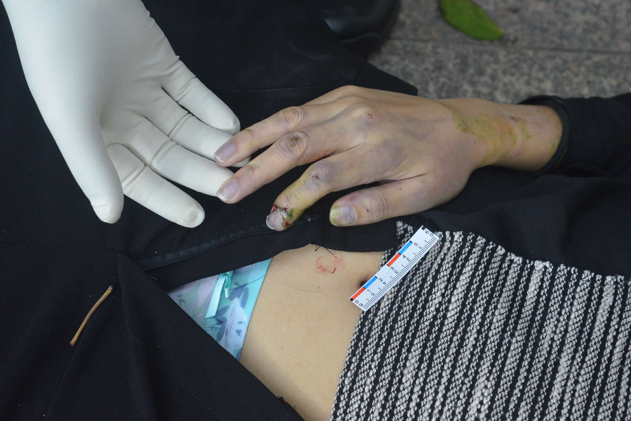 Poor Chinese Woman Murdered.